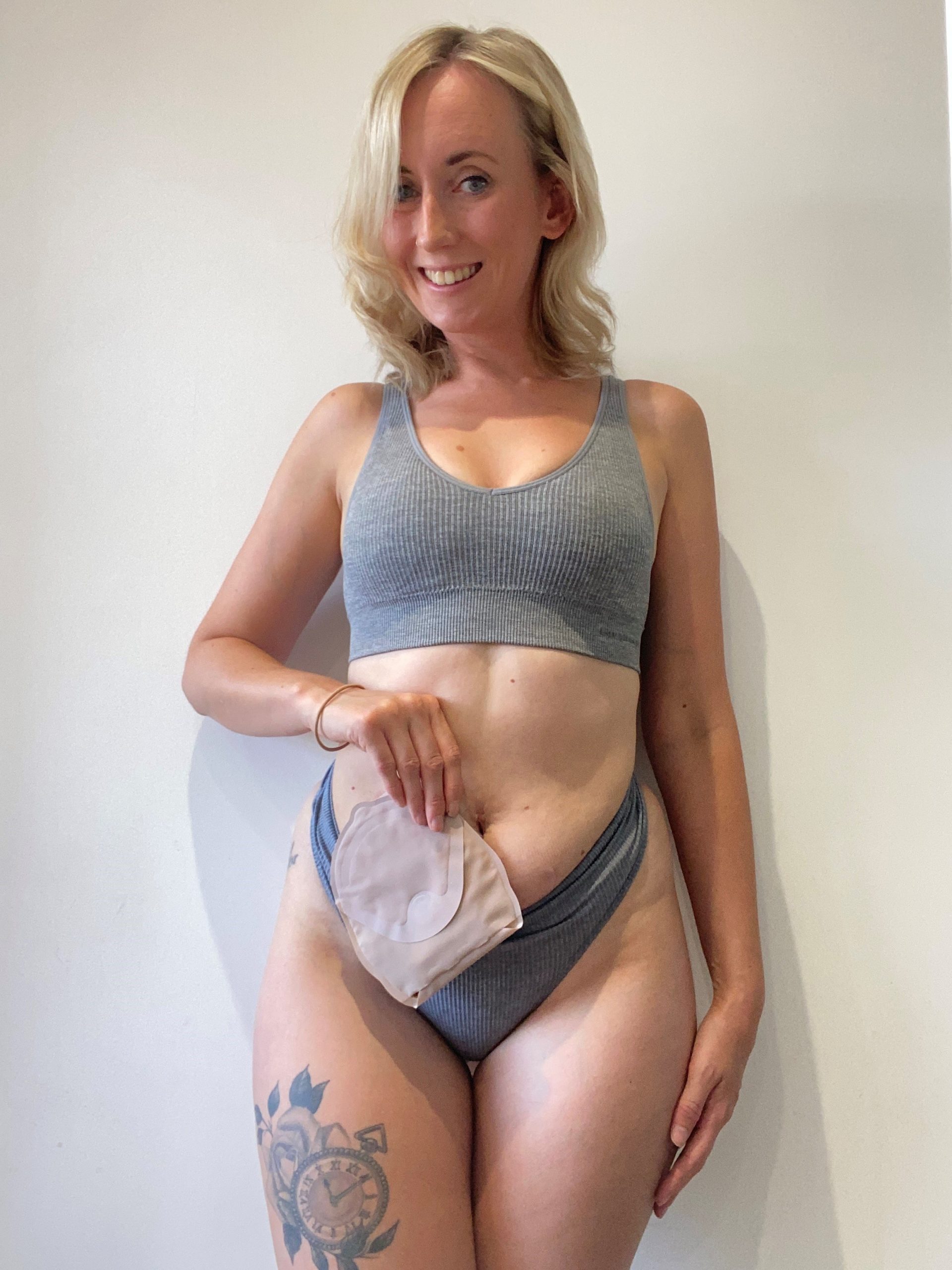 Lets Talk Sex After Stoma Surgery - Pelican Healthcare