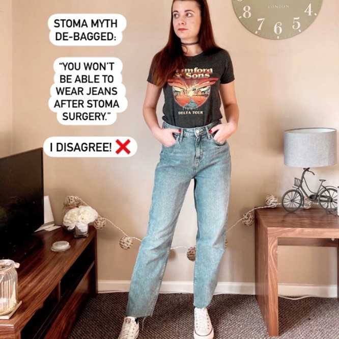 Ostomy Fashion  Living with Stacey Stoma.